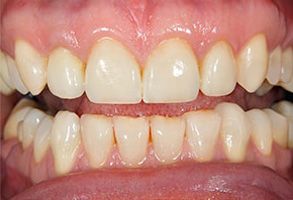 Plum Dental Associates | Dental Fillings, Implant Crowns and Sedation Dentistry