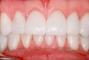 Plum Dental Associates | Invisalign reg , Cosmetic Dentistry and Preventative Program