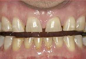 Plum Dental Associates | Oral Exams, Extractions and Emergency Treatment
